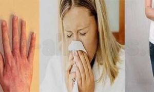 Аллергия после пилинга: причины, симптомы