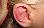 Аллергия на ухе, на ушах – что делать ребенку и взрослому