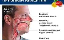 Зуд в горле как симптом аллергии