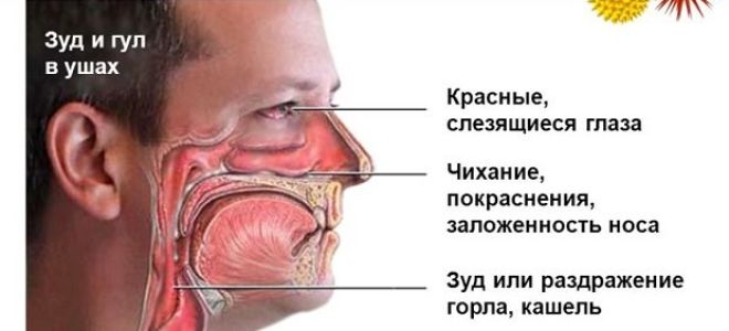 Зуд в горле как симптом аллергии