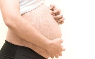 Аллергический дерматит у беременных