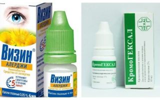 Список эффективных капель для глаз от аллергии, особенности препаратов