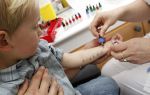 Диагностика аллергии у детей и взрослых