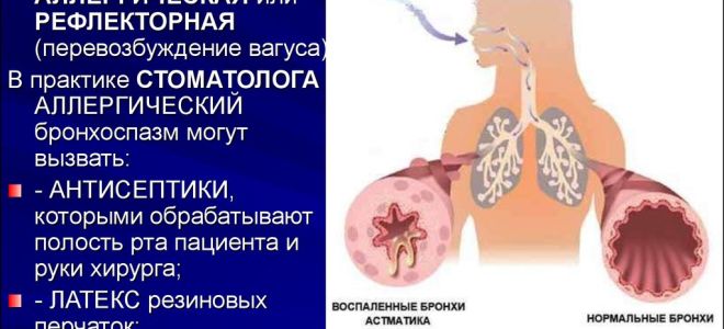 Инсектная аллергия: причины, лечение и профилактика