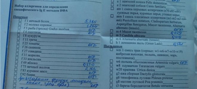 Все об анализах на аллергию